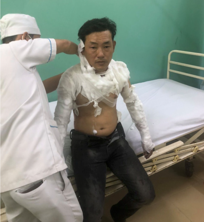 Hành động quái dị của kẻ cướp ngân hàng ở Bình Tân - Ảnh 1. Hành động quái dị của kẻ cướp ngân hàng ở Bình Tân - Ảnh 1.