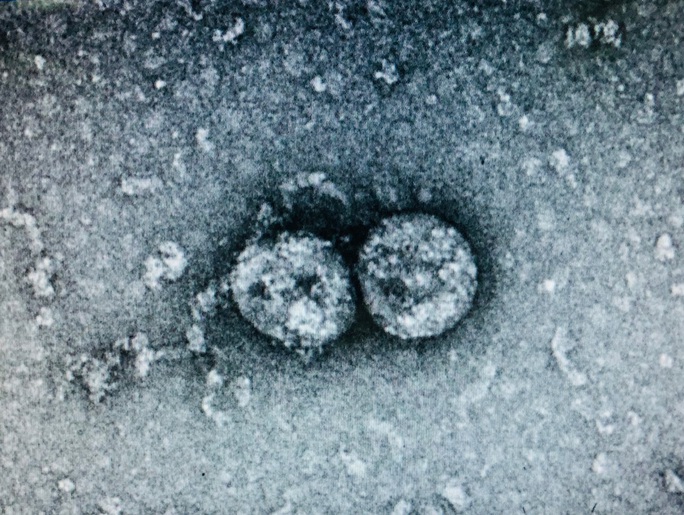 4 quốc gia phân lập thành công virus corona mới là những nước nào? - Ảnh 4. 4 quốc gia phân lập thành công virus corona mới là những nước nào? - Ảnh 4.