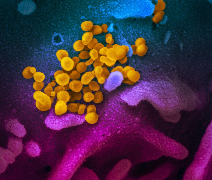 Tiết lộ hình ảnh mới của virus corona chủng mới - Ảnh 2. Tiết lộ hình ảnh mới của virus corona chủng mới - Ảnh 2.