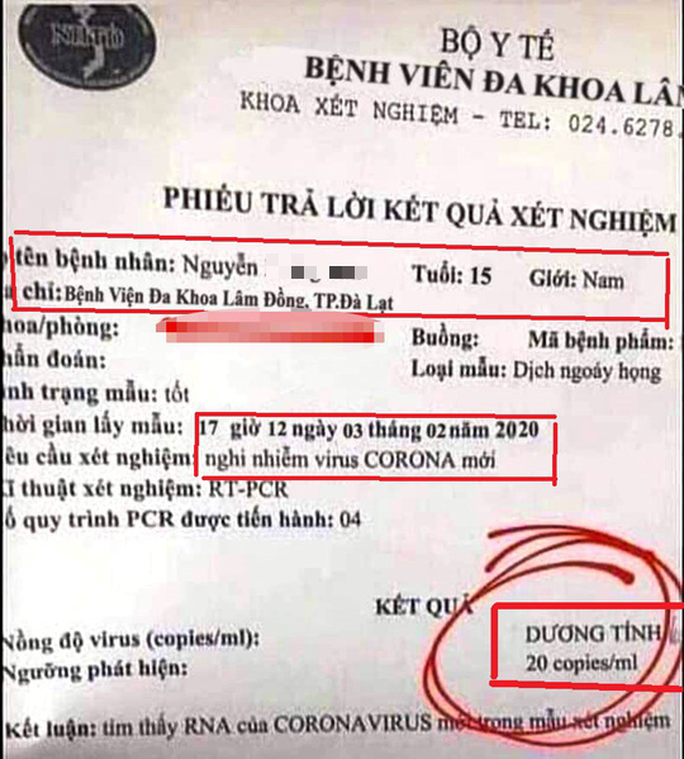 Hoang mang kết quả xét nghiệm dương tính với virus corona giả mạo ở Lâm Đồng - Ảnh 1. Hoang mang kết quả xét nghiệm dương tính với virus corona giả mạo ở Lâm Đồng - Ảnh 1.