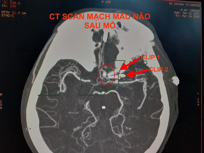 4 giờ căng thẳng giành lấy sự sống cho người đàn ông đối diện cái chết - Ảnh 2. 4 giờ căng thẳng giành lấy sự sống cho người đàn ông đối diện cái chết - Ảnh 2.