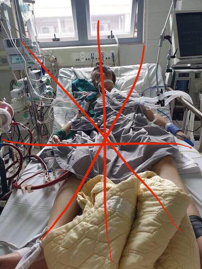 Bộ Y tế lên tiếng về bức ảnh nữ bệnh nhân nguy kịch được cho là cô gái nhiễm Covid-19 ở Hà Nội - Ảnh 1.