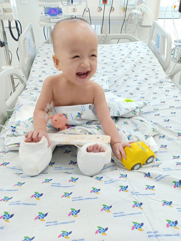 Trúc Nhi- Diệu Nhi: Một ca mổ, hai cuộc đời - Ảnh 1. Trúc Nhi- Diệu Nhi: Một ca mổ, hai cuộc đời - Ảnh 1.