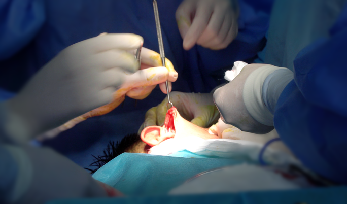 Đôi mắt đỏ ngầu của vị bác sĩ sau ca đại phẫu chàng trai mặt quỷ - Ảnh 2. Đôi mắt đỏ ngầu của vị bác sĩ sau ca đại phẫu chàng trai mặt quỷ - Ảnh 2.
