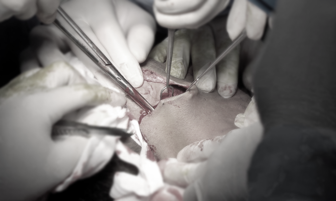 Đôi mắt đỏ ngầu của vị bác sĩ sau ca đại phẫu chàng trai mặt quỷ - Ảnh 3. Đôi mắt đỏ ngầu của vị bác sĩ sau ca đại phẫu chàng trai mặt quỷ - Ảnh 3.