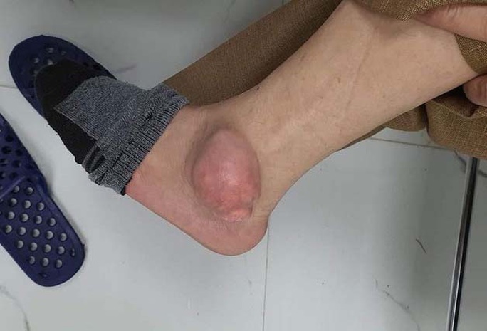 Cảnh báo chữa gout bằng thuốc mua qua mạng - Ảnh 1. Cảnh báo chữa gout bằng thuốc mua qua mạng - Ảnh 1.