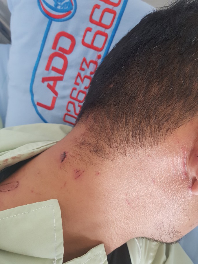 Clip: Một người bị nhiều người đánh ngay trung tâm huyện Lâm Hà - Ảnh 4.