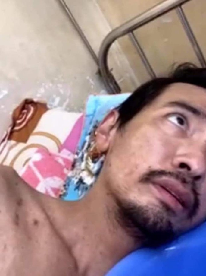 Ca sĩ Việt Quang bị viêm phổi nặng, sụt cân đến xót xa - Ảnh 2.