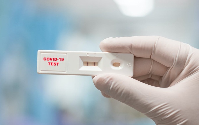 Bộ Y tế lý giải giá test xét nghiệm Covid-19 khác nhau - Ảnh 2.
