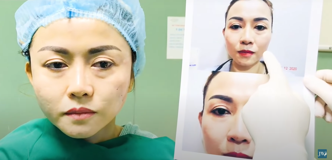 Bệnh viện JW trình làng công nghệ mới “Cải lão gương mặt 3M” đẹp 0 tuổi - giá 0 đồng - Ảnh 2.
