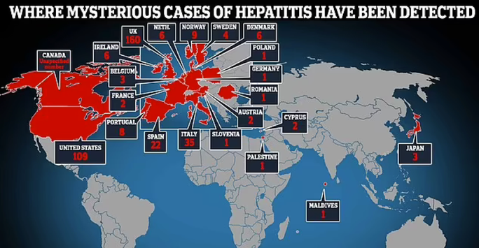 Bệnh viêm gan bí ẩn tiếp tục diễn biến phức tạp trên toàn thế giới - Ảnh 1.
