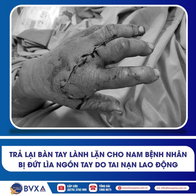 Người đàn ông đến bệnh viện với 2 ngón tay đứt lìa được ướp đá - Ảnh 1.