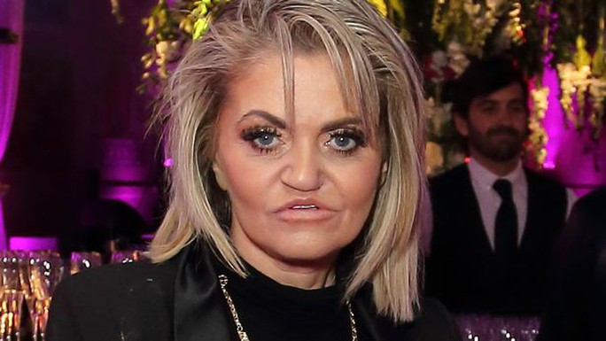 3danniella-westbrook-shows-off-new-face-1653211831673123485241.jpg