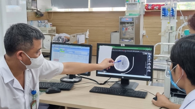 Cô gái trẻ hôn mê, phù não sau hút thuốc lá điện tử - Ảnh 2. Cô gái trẻ hôn mê, phù não sau hút thuốc lá điện tử - Ảnh 2.