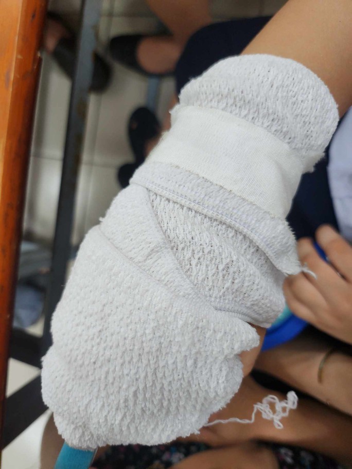 TP HCM: Phụ huynh tố giáo viên đánh gãy xương ngón tay học sinh - Ảnh 2.