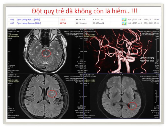 Cảnh báo với bệnh cứ 5 người thì 1 mắc  - Ảnh 1.