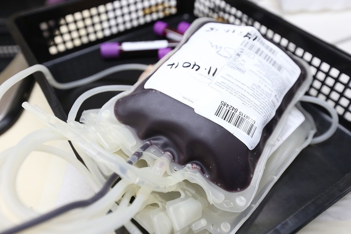 Viện Karolinska: Nguy cơ đột quỵ có thể bị “lây” qua truyền máu - Ảnh 1.