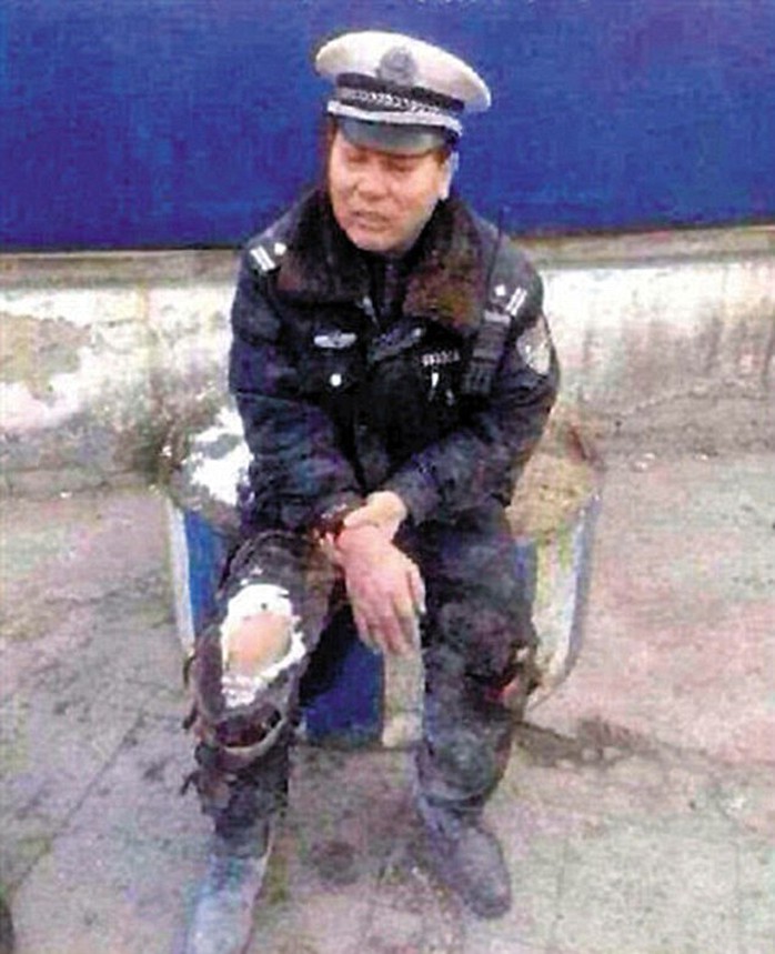 Cảnh sát Hsin bị thương nhẹ sau khi cự cãi với tài xế. Ảnh: Daily Mail
