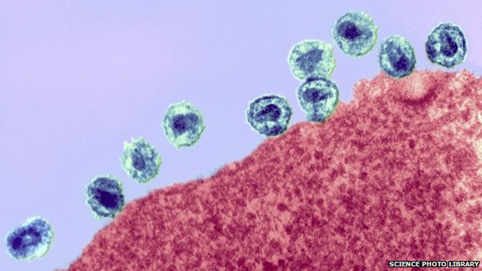 16% trong số 1,1 triệu người ở Mỹ sống chung với virus mà không biết họ bị nhiễm. Ảnh: Science Photo Library