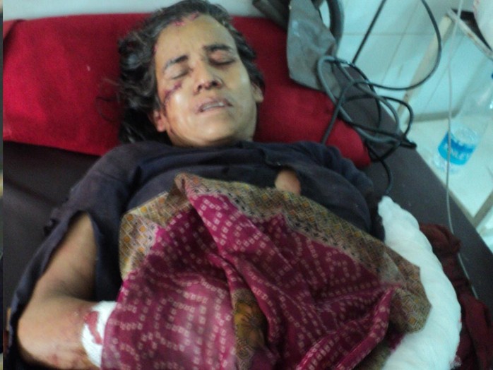 Bà Kamla Devi tại bệnh viện. Ảnh: Hindustan Times