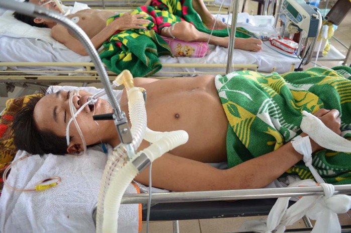 Thanh niên bị chấn thương sọ não đang được cấp cứu tại Bệnh viện Đa khoa Quảng Ngãi.