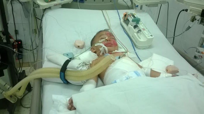Bé Thiên Hòa đang được điều trị tại Bệnh viện nhi đồng Đồng Nai