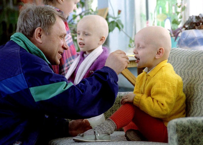 Hai đứa trẻ bị ung thư do tác động của thảm họa được điều trị tại một bệnh viện đặc biệt ở Minsk - Belarus năm 1996. Ảnh: Reuters