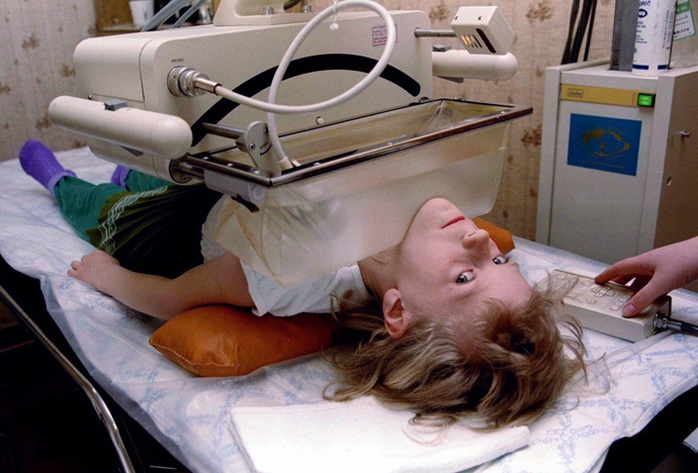 Bé gái Olga Derzhutskaya, 6 tuổi bị ung thư do ảnh hưởng của thảm họa (ảnh chụp năm 1996). Ảnh: Reuters