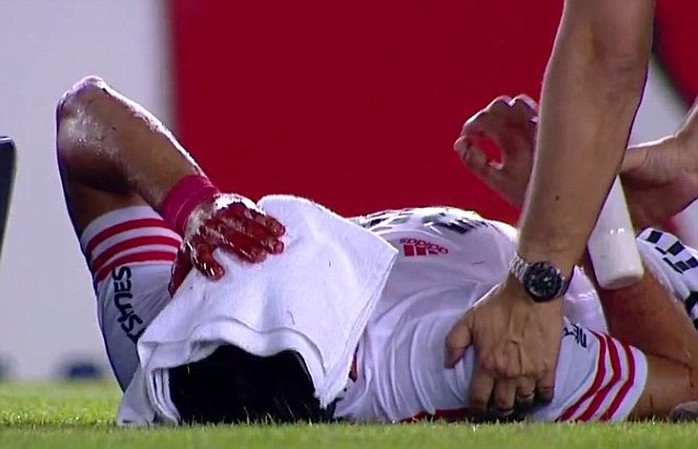 Rojas nằm trên sân với kkhuôn mặt đầy máu