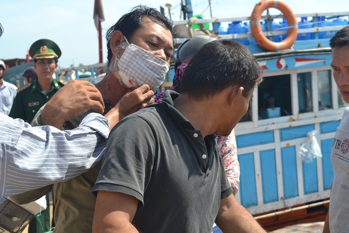 Ngư dân Lê Văn Hường bị mảnh kính văng vào cổ