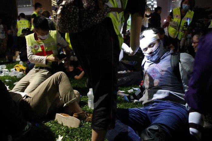 Nhiều người bị vết thương hở ở đầu. Ảnh: Reuters