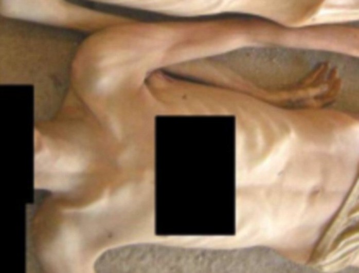 Shocking: This picture is one of 55,000 taken by a Syrian military police defector showing emaciated corpses which investigators say are evidence of extreme torture by Assads regime. Photographs: The Report