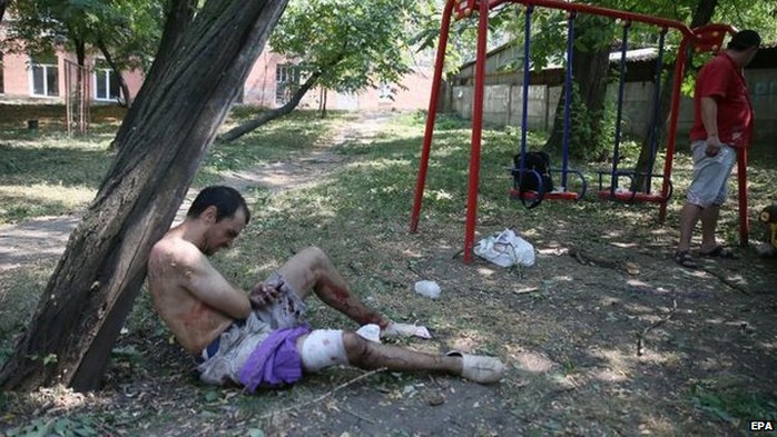 A man treats his own wounds after shelling in Donetsk, 14 Aug