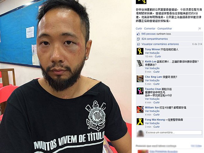 Postagem da página do Partido Cívico no Facebook mostra Tsang ferido após suposta agressão de policiais em Hong Kong (Foto: Reprodução/Facebook)