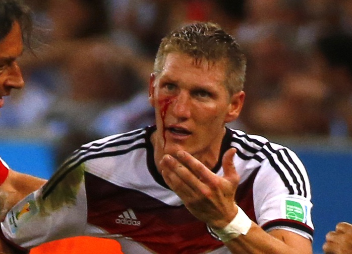 Schweinsteiger với khuôn mặt máu sau pha va chạm với Aguero