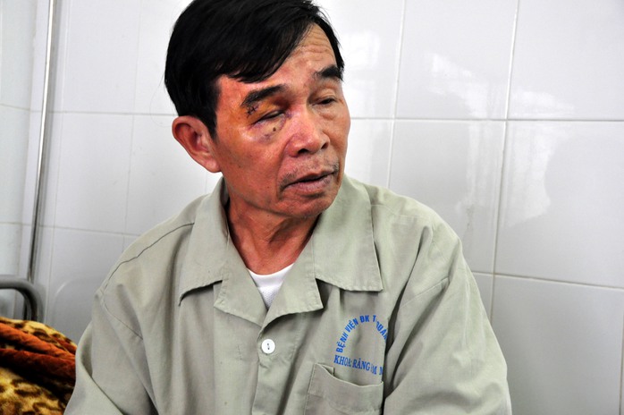 Ông Nguyễn Quốc Chinh, Chủ tịch Nghiệp đoàn Nghề cá An Hải, Lý Sơn đang được điều trị tại bệnh viện.