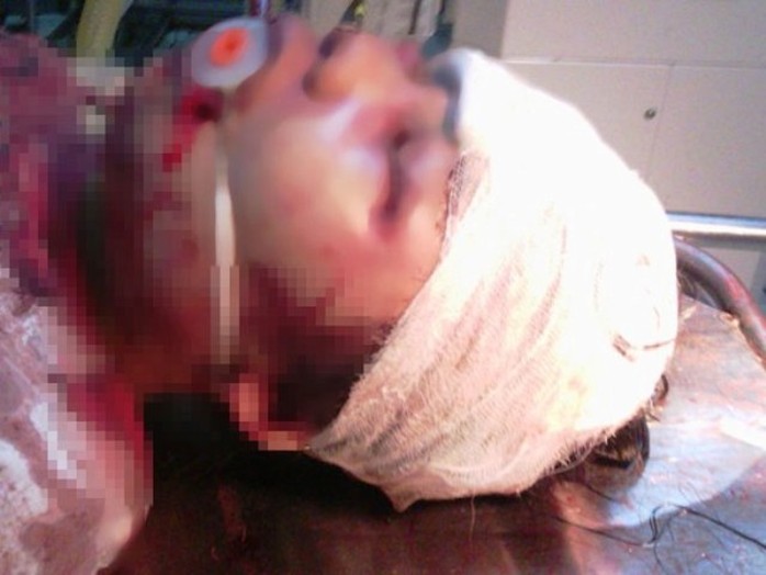 Hình ảnh cháu bé Đỗ Thị Oanh bị Nguyễn Công Văn đánh dã man khi cấp cứu tại Bệnh viện Đa khoa Hợp Lực - Thanh Hóa