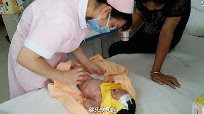Em bé hở hàm ếch bị bỏ lại khu vực nông thôn thuộc tỉnh Quảng Tây hồi tháng 5 được cứu sống. Ảnh: CCTV