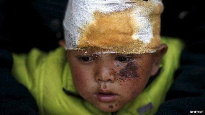 Abhishek Tamang, 4, looks on after receiving medical treatment, following Saturdays earthquake, at Dhading hospital, in Dhading Besi, Nepal April 27, 2015.