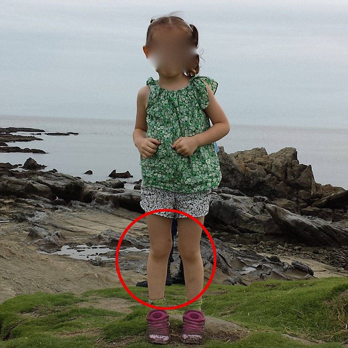 Đôi giày đen bí ẩn và một mảnh áo màu xanh phía sau chân và lưng con gái ông Springall (khoanh đỏ). Ảnh: Daily Mail