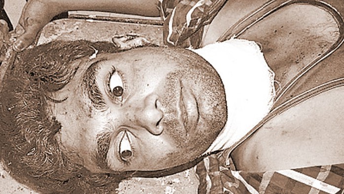 Anh Rajveer Singh đã tỉnh lại trong bệnh viện. Ảnh: Hindustan Times