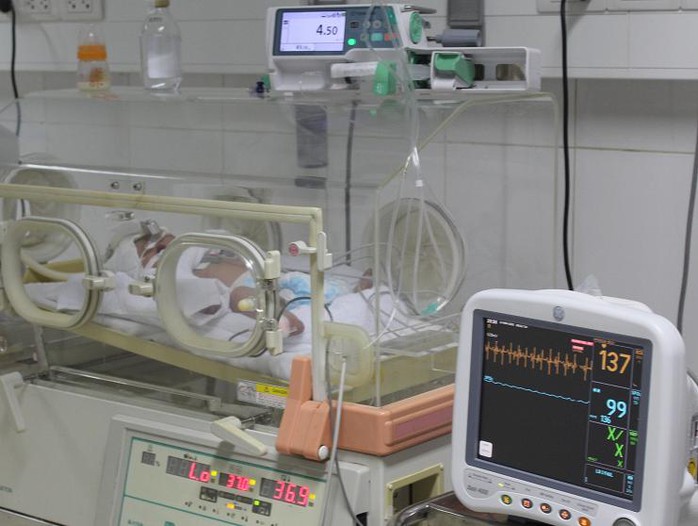Bé sơ sinh con sản phụ Thương đang được điều trị tại BV Đa khoa Nghệ An.