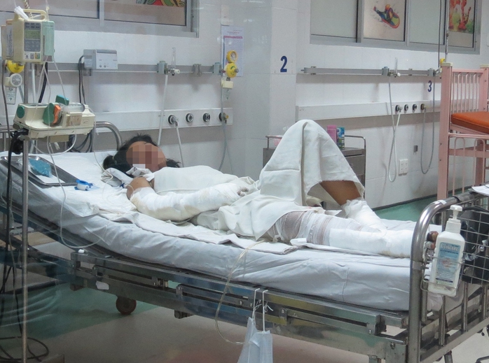 Bé Linh vẫn đang được điều trị tại khoa Phỏng - tạo hình, BV Nhi Đồng 1