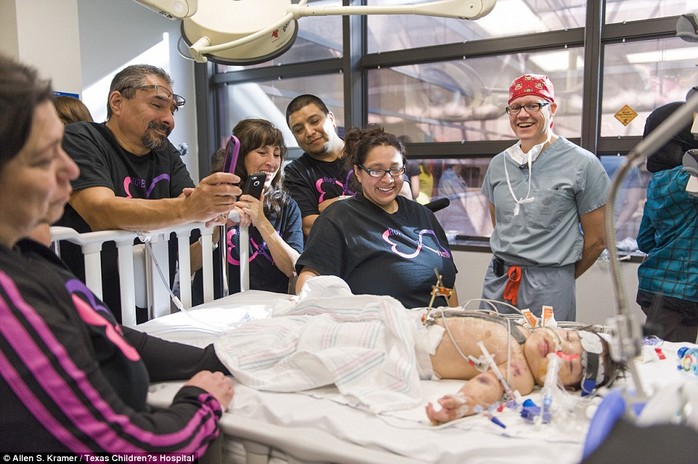 Doctors and family members gather around the other girl as she recovers from surgery. The operation to separate them lasted a total of 26 hours 