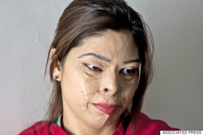 Chị Kanwal Asher, 24 tuổi