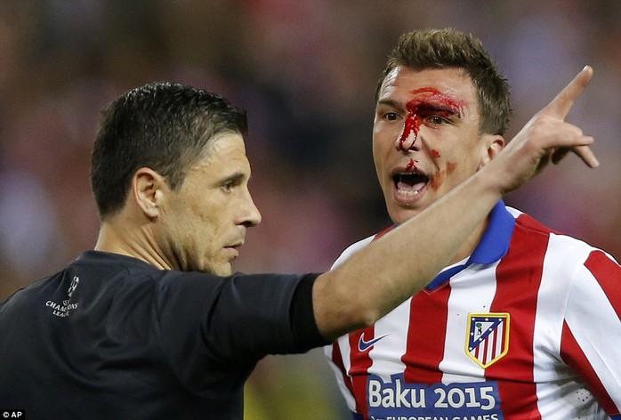 Máu đổ trên mặt Mandzukic sau pha tranh chấp với Ramos