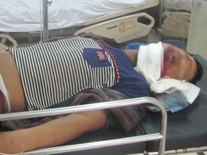 Một công nhân bị thương nặng trong vụ sập giàn giáo tại dự án Formosa ngày 27-7-2014 được cấp cứu tại bênh viện. Ảnh: Dũng Nguyên