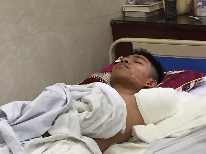 
Nguyễn Văn Quảng nổi tiếng trong cộng đồng mạng vì cứu bạn nên đã bị cụt một cánh tay trái
