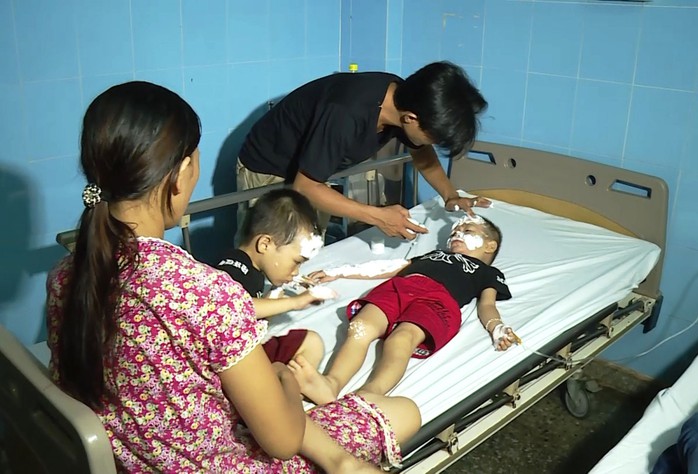
Nhiều trẻ em được đưa vào bệnh viện cấp cứu trong tình trạng bị bỏng
