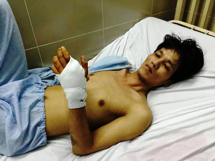 
Anh Nguyễn Ngọc Lâm bị bắn thủng bàn tay trái đang điều trị tại bệnh viện
